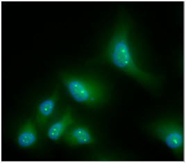 ICC IF of CBR1 in HeLa cells with STJA0041741 antibody and Alexa Fluor 488